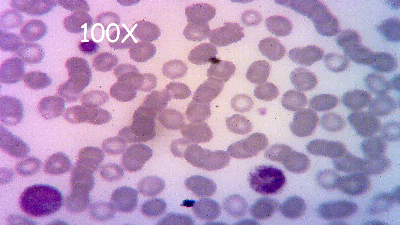 con que microscopio se ven los globulos rojos