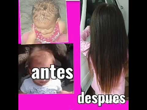 porque a mi hija no le crece el cabello