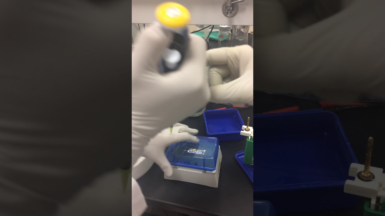 porque el azul de coomassie tiñe las proteínas