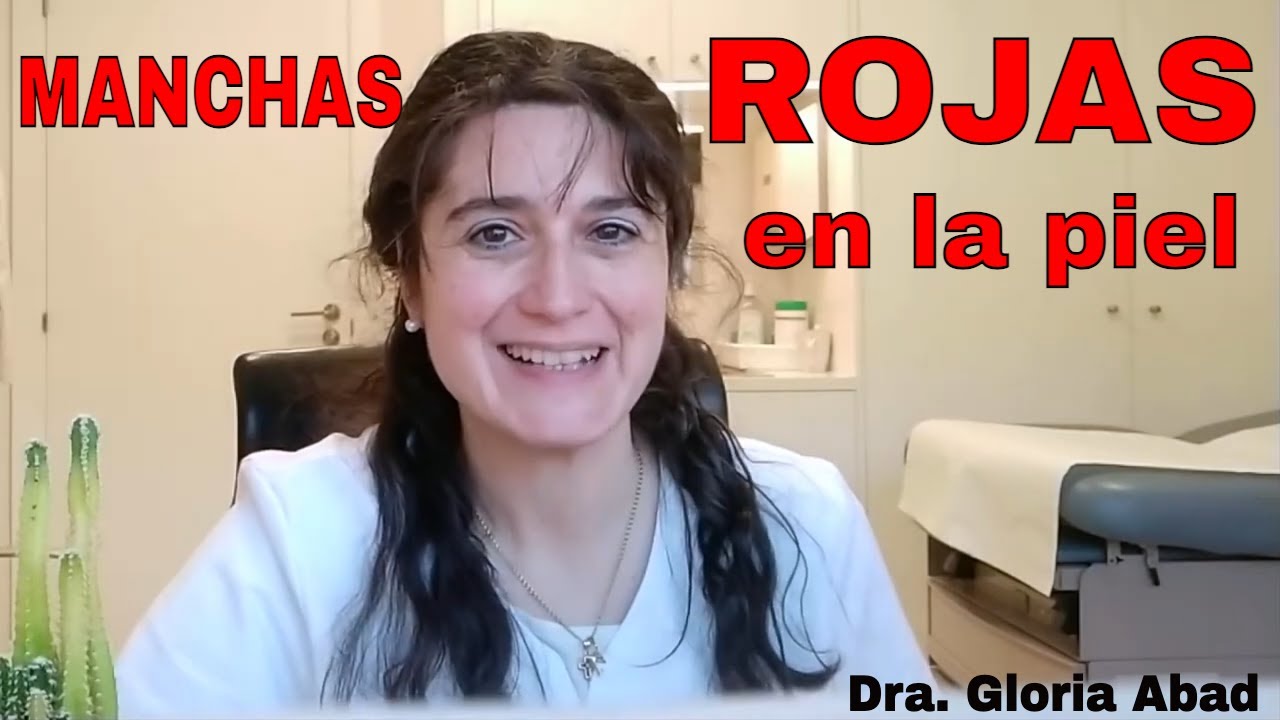 que pasa cuando te salen manchas rojas en la piel