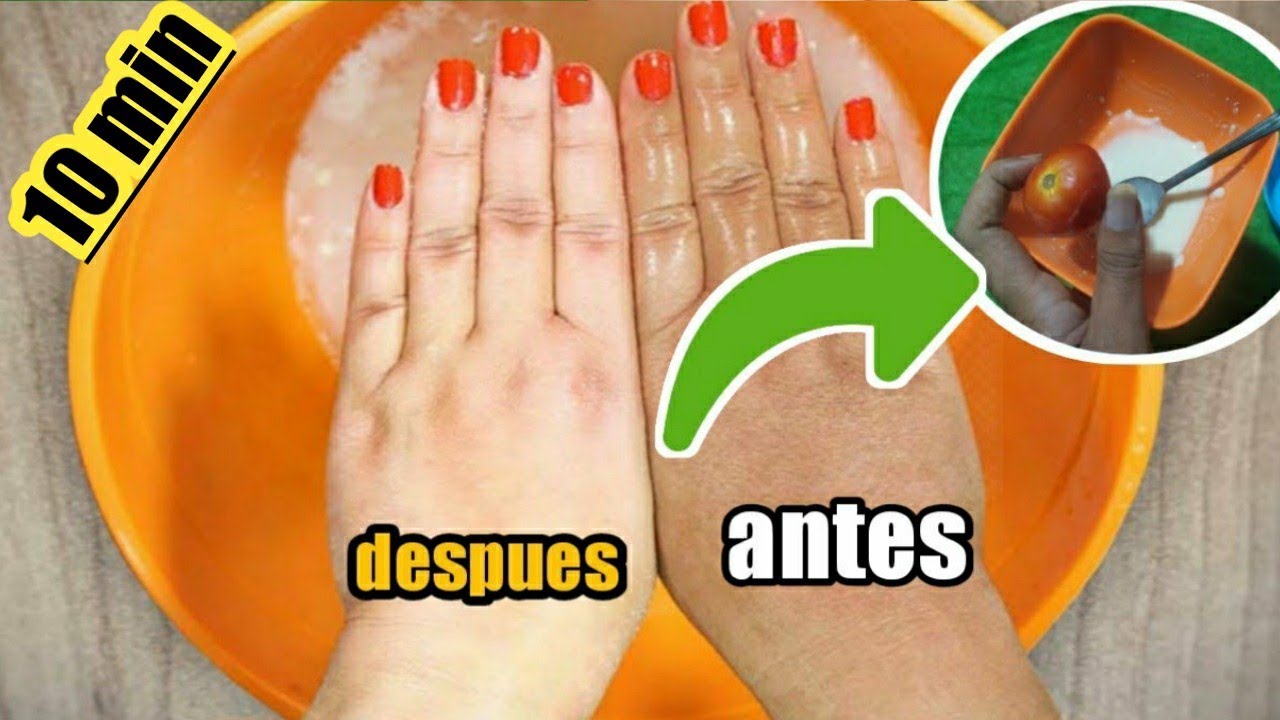 como blanquear la piel quemada por el sol rapidamente