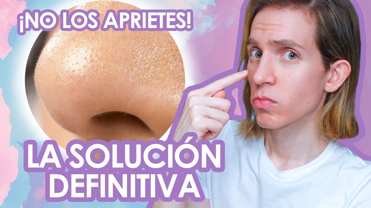 como eliminar los puntos negros de la nariz