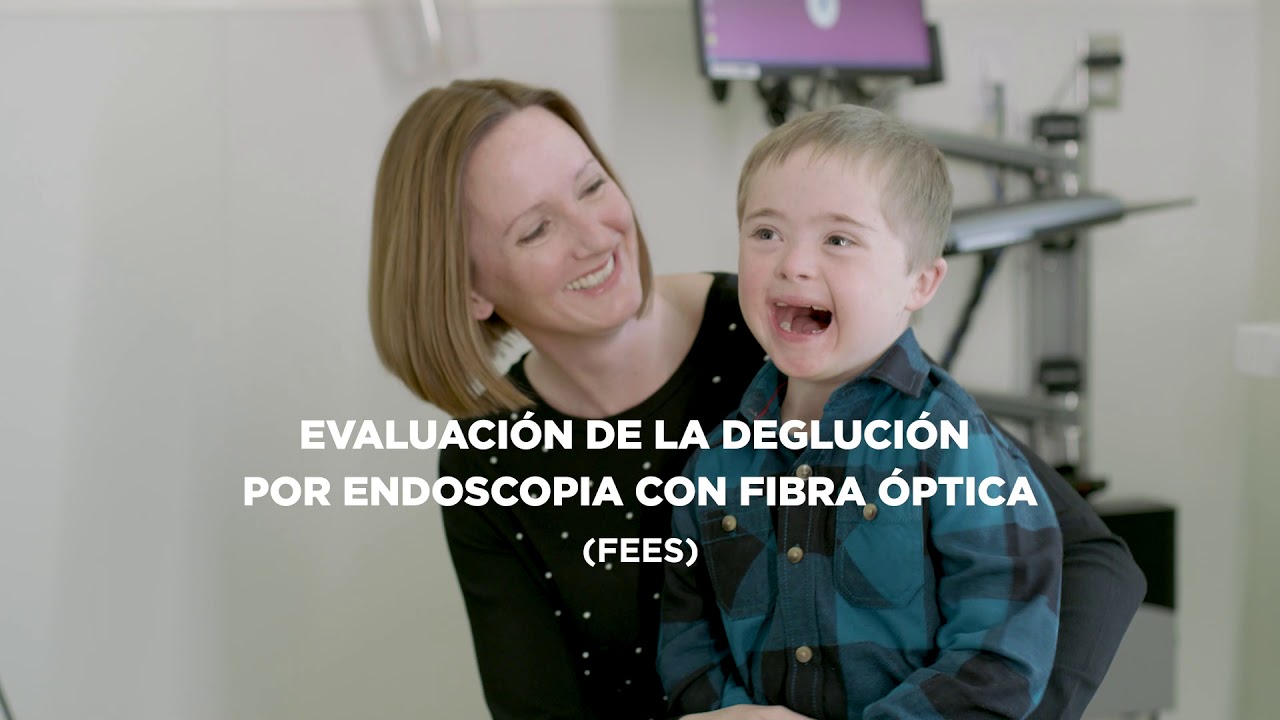 dificultades de los niños con sindrome de down